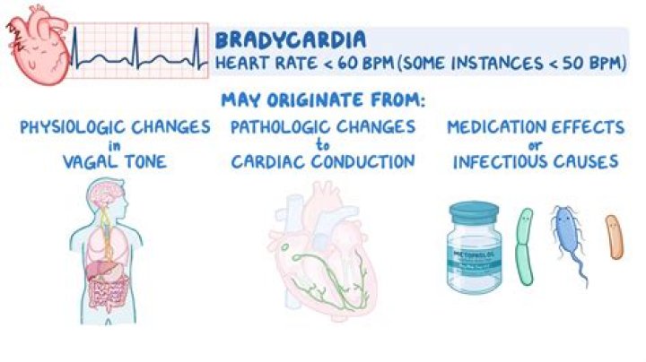 Can a brain tumor cause bradycardia?