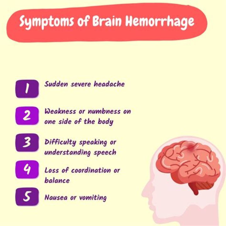 Can a person survive after brain hemorrhage?