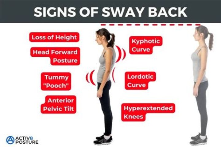 Can a swayback cause back pain?