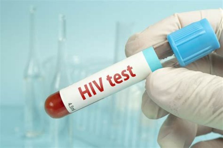 Can MP test detect HIV?