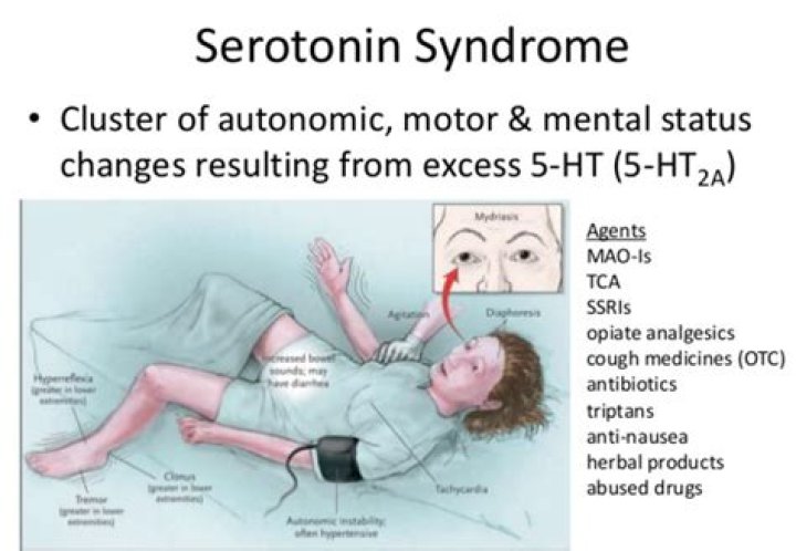 Can serotonin syndrome happen naturally?