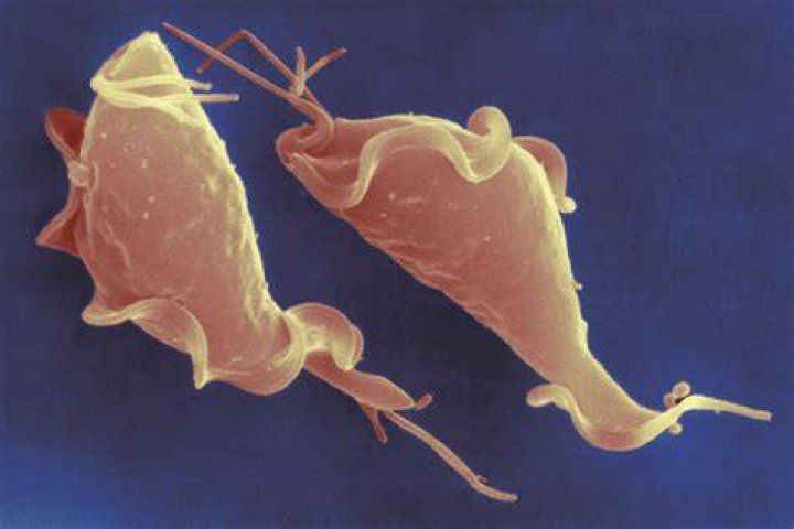 Can you see trichomoniasis parasite?