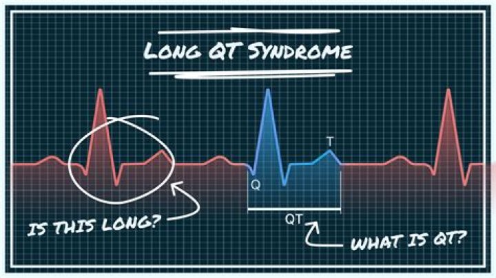 Does alcohol affect Long QT Syndrome?