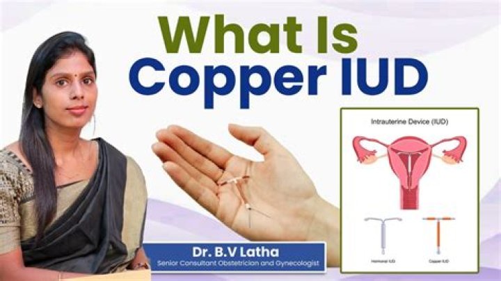 Does copper IUD have nickel?
