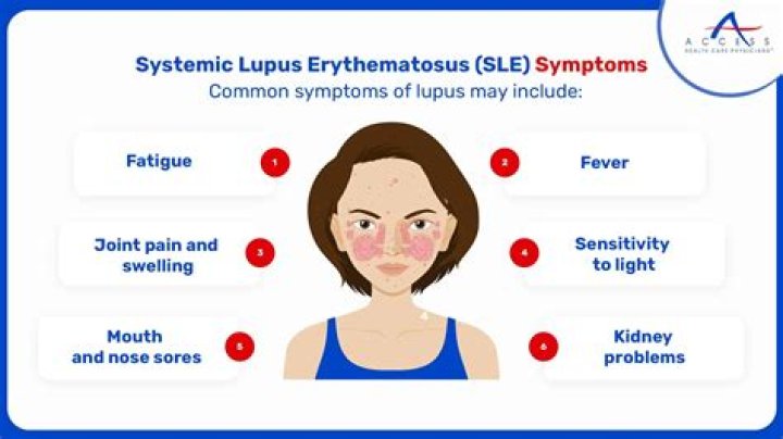 Does lupus make you nauseated?