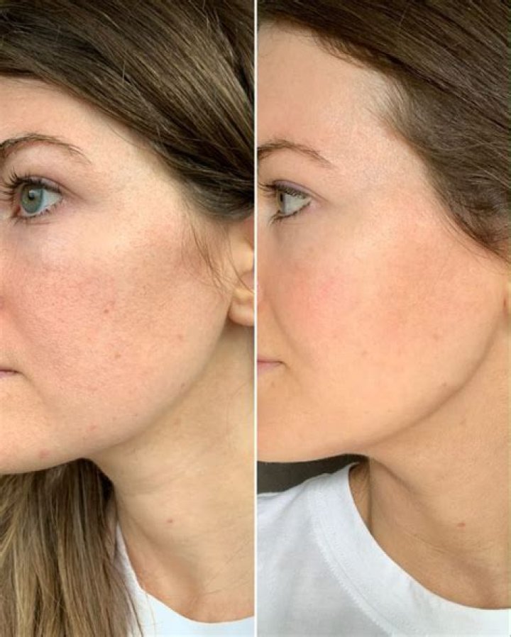 Does Olay Complete help with wrinkles?