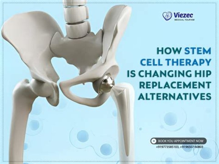 Does stem cell therapy work for hip replacement?