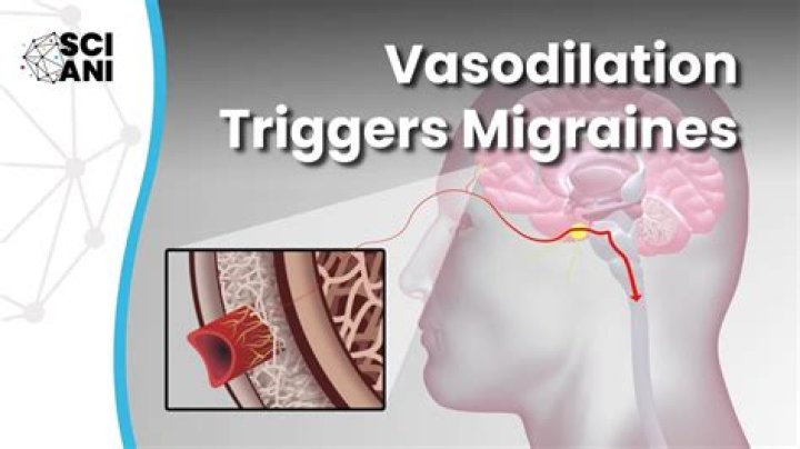 Does vasodilation in brain cause headaches?