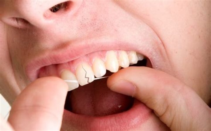 How can I tell if I have a hairline fracture in my jaw?