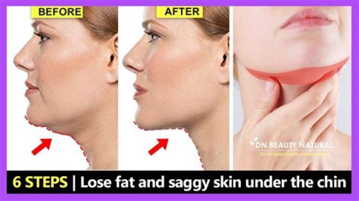 How do I get rid of the lump under my chin?