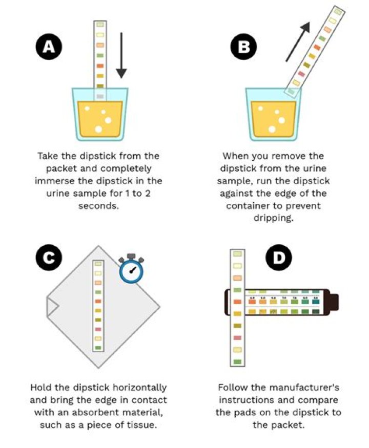 How do you do a White test?