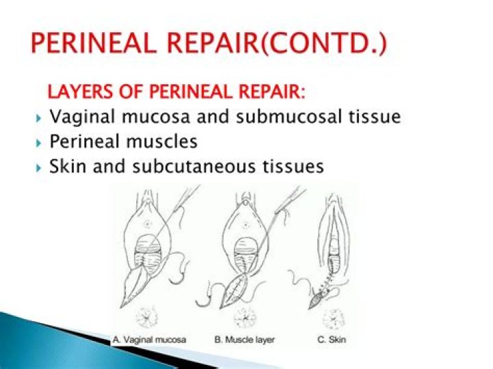 How do you fix perineum?