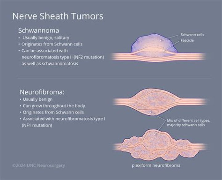 How do you stop neurofibromas from growing?
