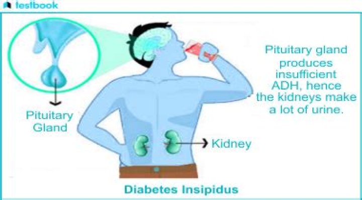 How does diabetes insipidus affect the body?
