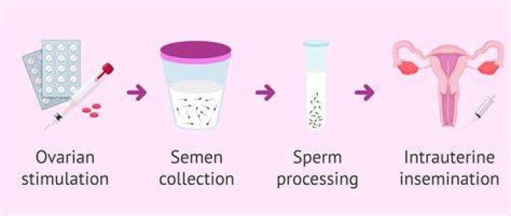 How effective is artificial insemination?