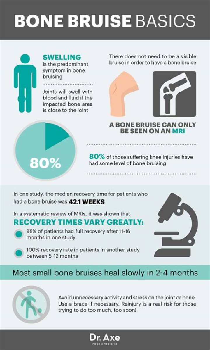 How long does a hip bone bruise take to heal?
