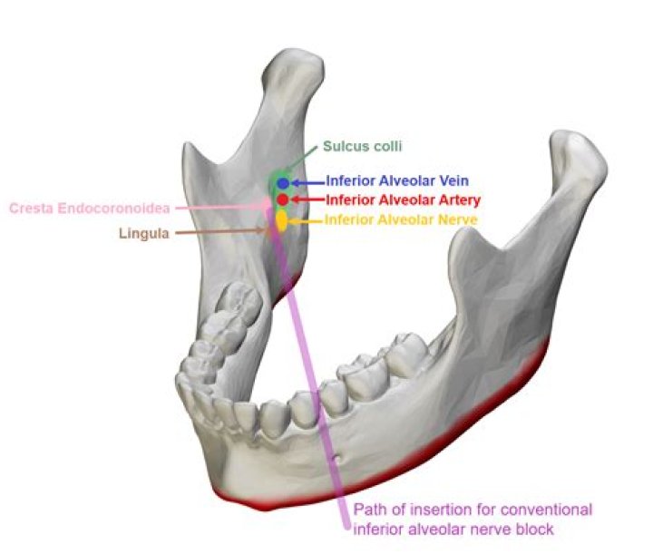 How long does it take for inferior alveolar nerve to heal?