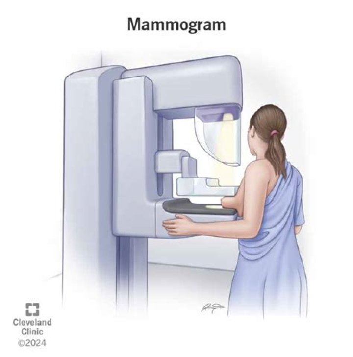How much is a mammogram in Australia?