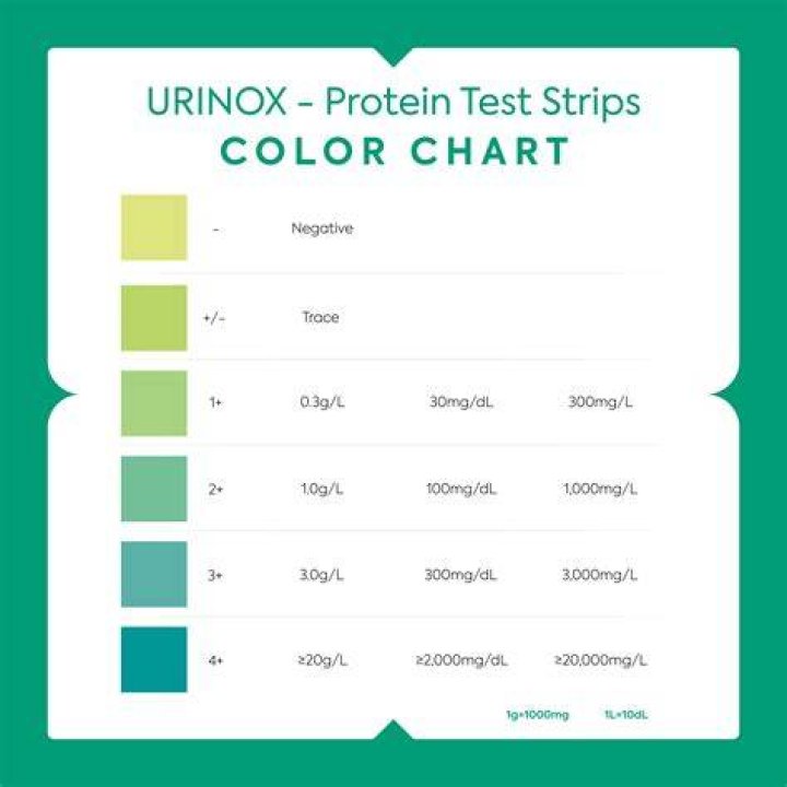 Is 2+ protein in urine high?