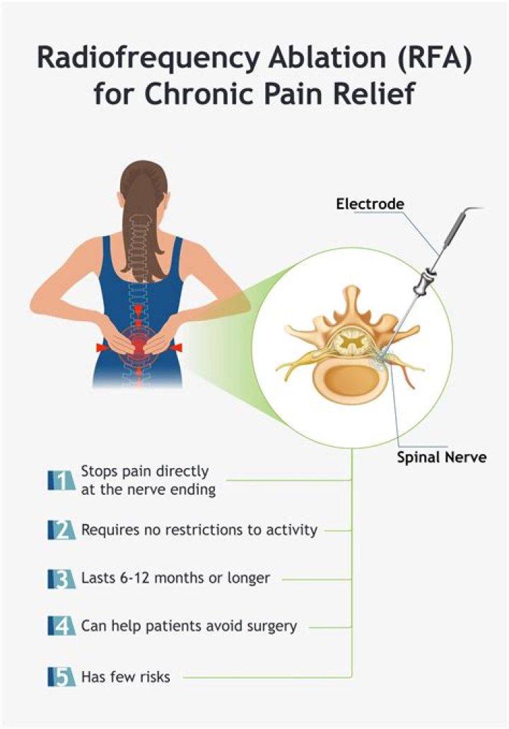 Is radiofrequency vein ablation painful?