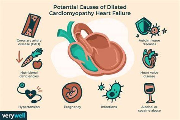 What are the 3 main causes of dilated cardiomyopathy?