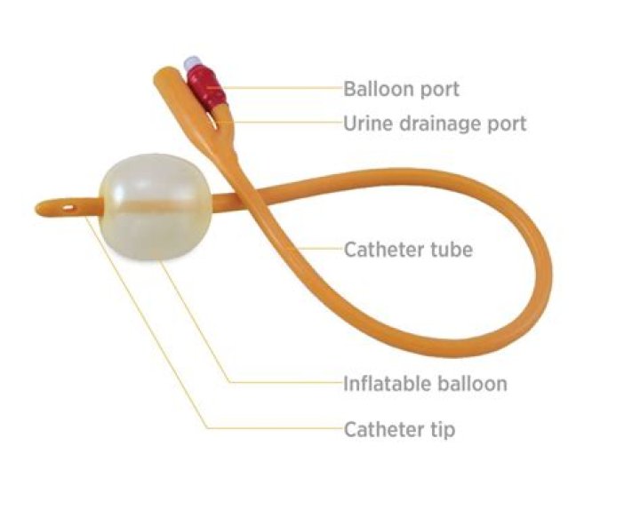 What are the side effects of having a catheter?
