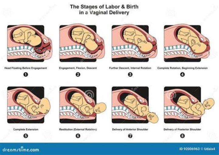 What are the stages of Labour?