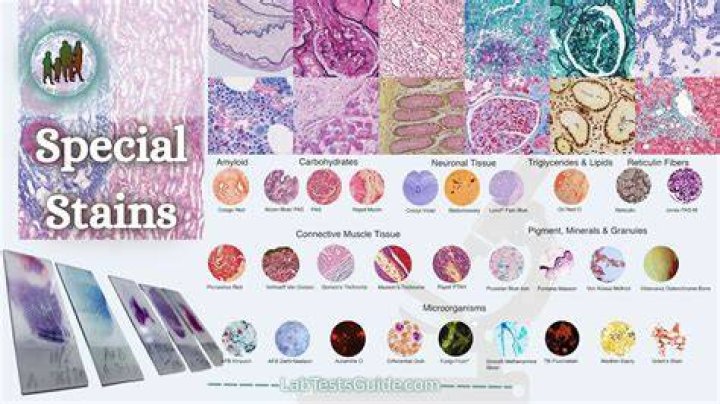 What are the stains which can be used to demonstrate mucin?