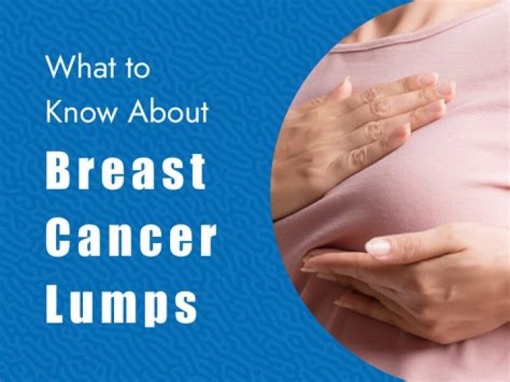 What can breast lumps be other than cancer?