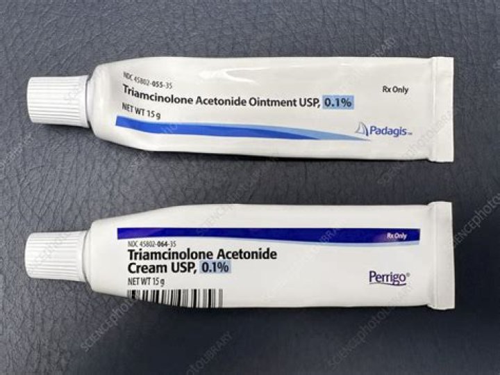 What can steroid cream be used for?