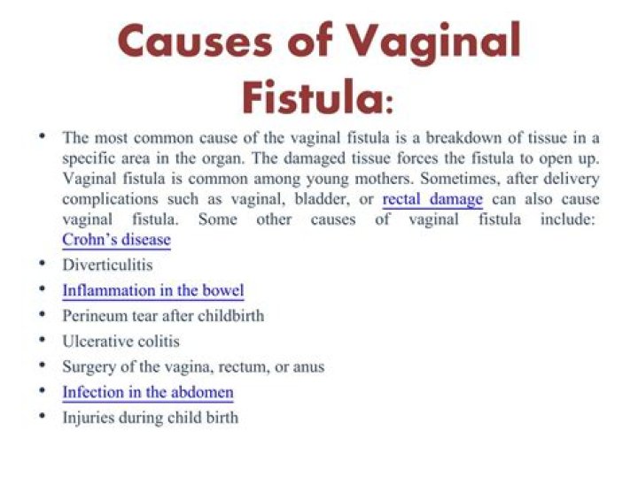 What causes fistula in female?
