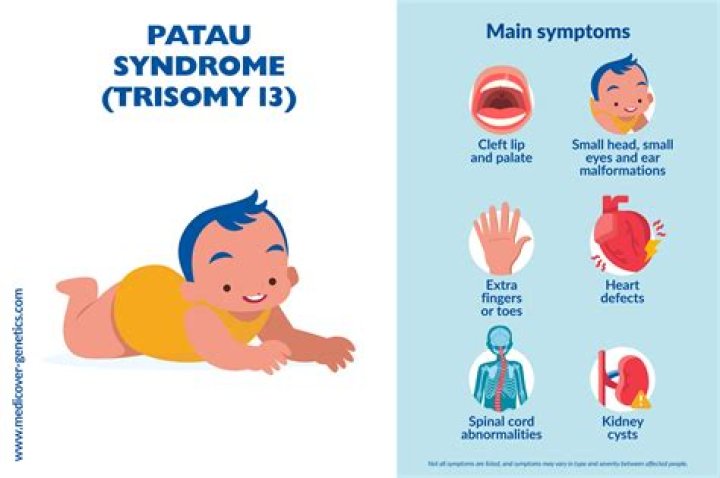 What chromosome is affected by Patau syndrome?