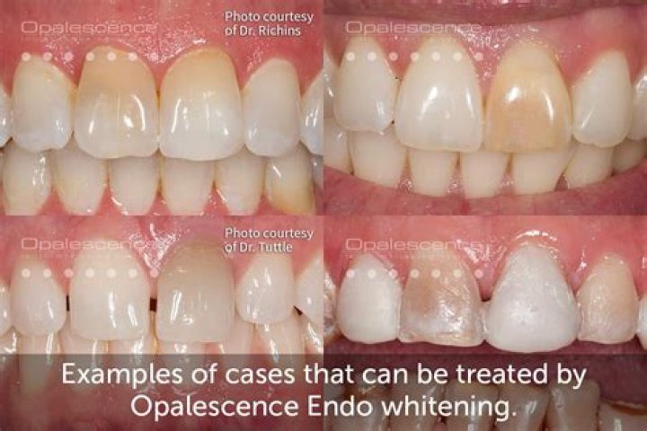 What does opalescence mean?