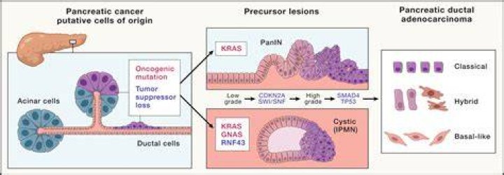 What genes are mutated in pancreatic cancer?