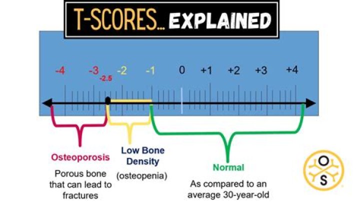 What is a good T score on pellet B?