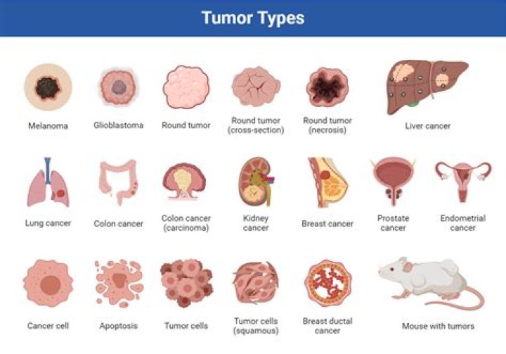 What is a tumor specifically?