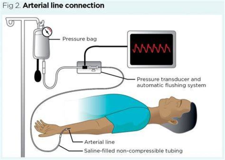 What is an arterial pressure point?