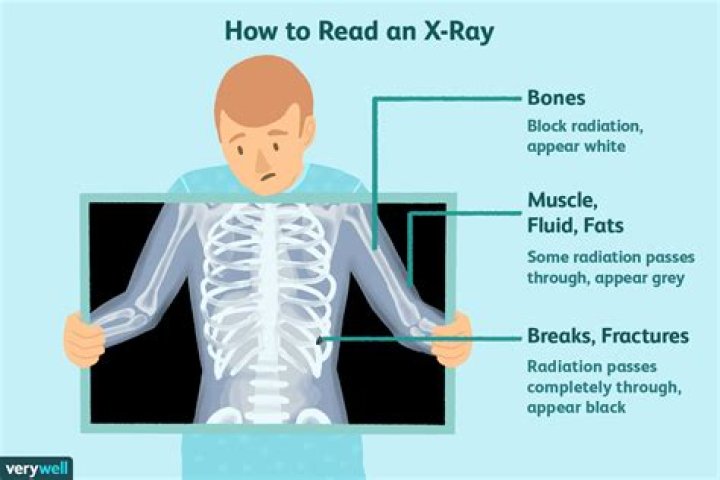 What is an x-ray technique chart?