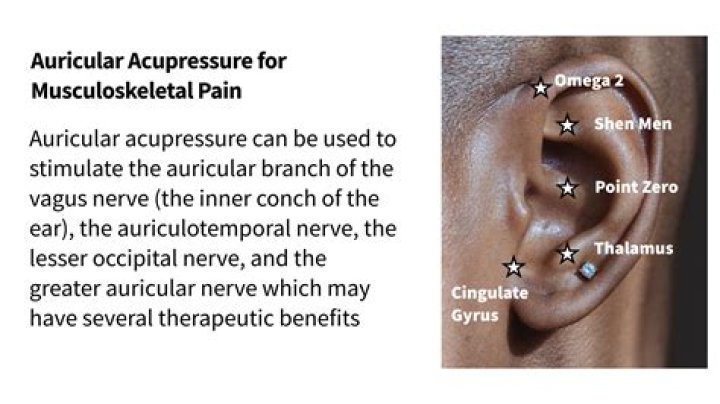 What is auricular acupuncture used for?