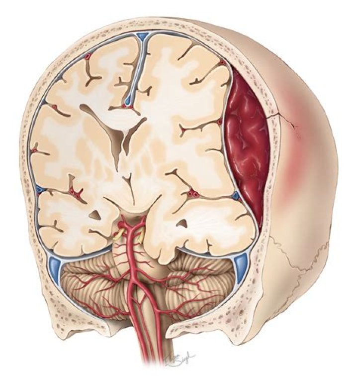 What is epidural anatomy?