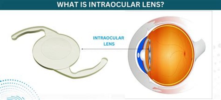 What is interocular transfer quizlet?