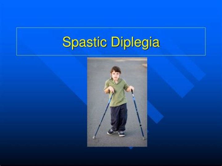 What is spastic diplegia?