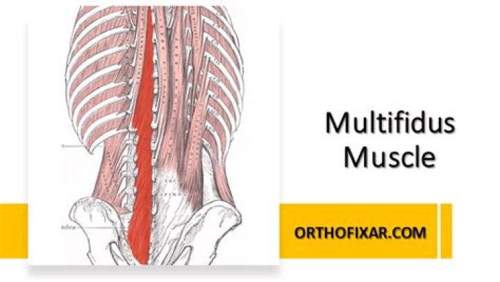 What is the action of the multifidus muscle?