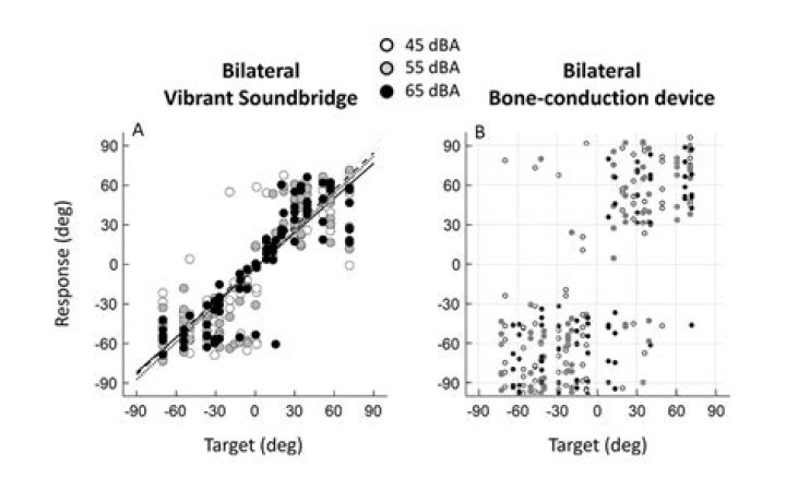 What is Vibrant Soundbridge?