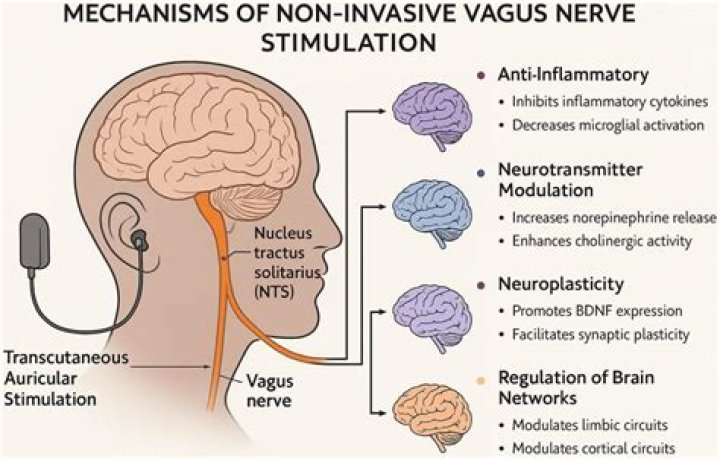 What is VNS interrogation?