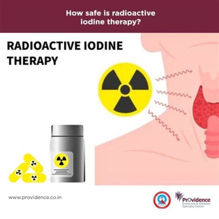 What precautions should be taken with radioactive iodine RAI therapy?