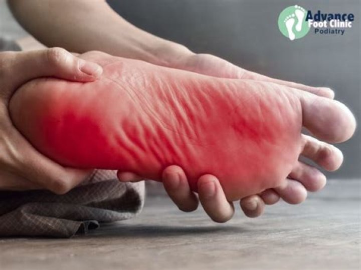 What should I do if my feet are burning?