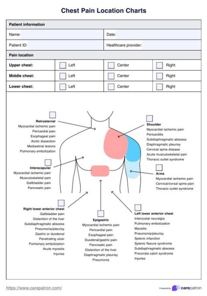 Where is chest pain located woman?
