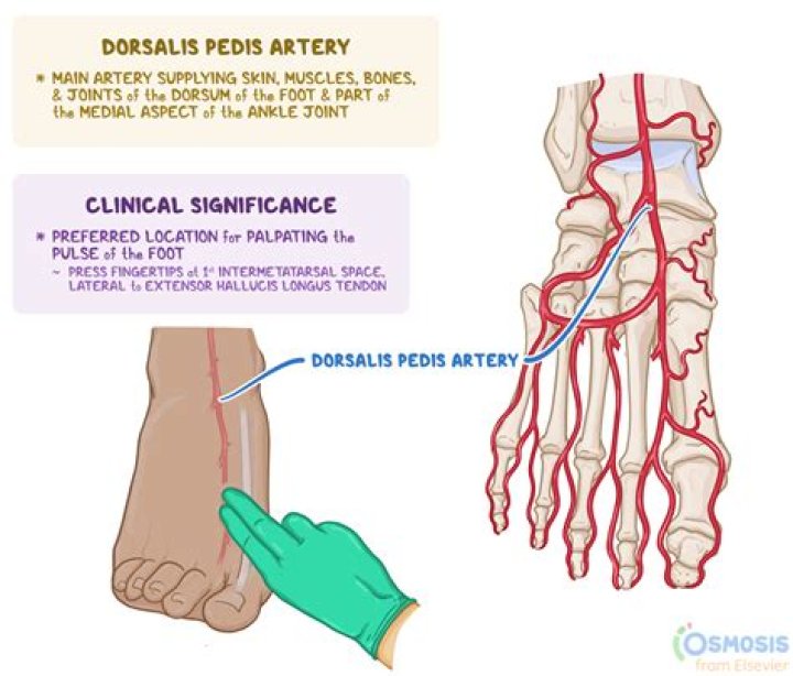 Where is the dorsalis artery located?