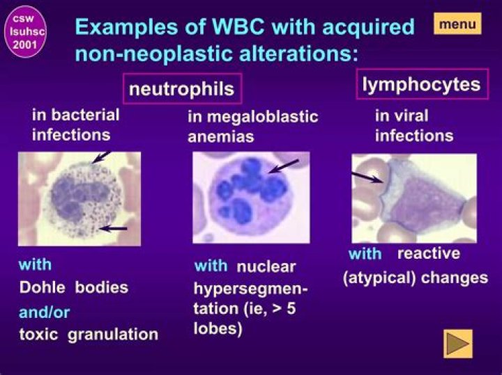 Which WBC differential indicates a bacterial infection?